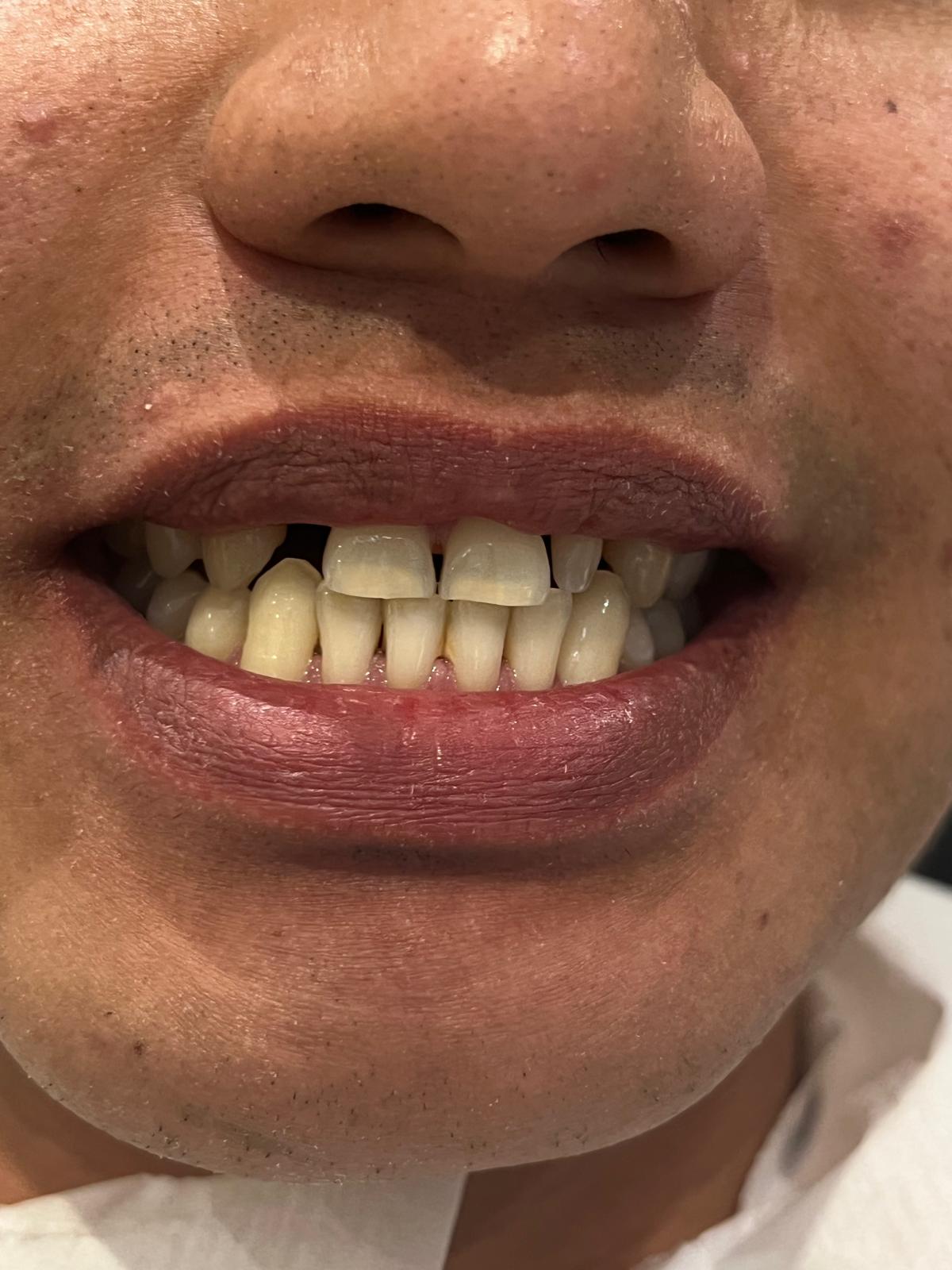ECE Dental Patient Transformation